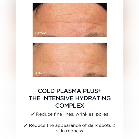 Perricone MD Cold Plasma Set - Picture 3 of 4